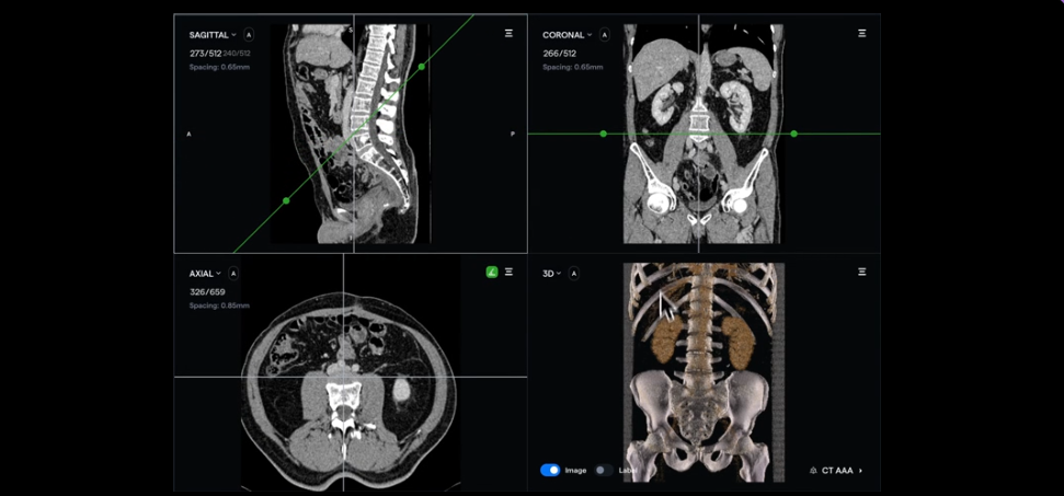 Improved 3D rendering for Redbrick.ai